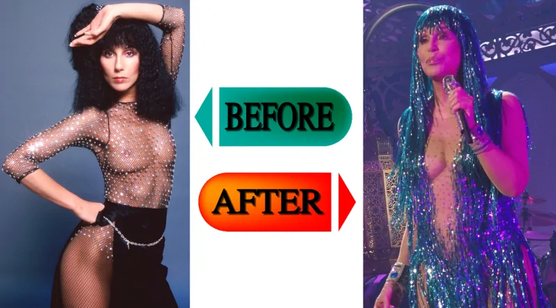 Cher boob job before and after